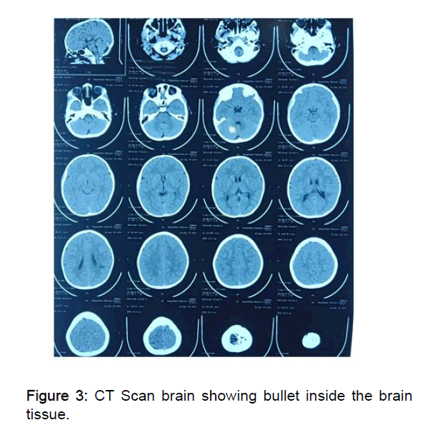 neurology-brain