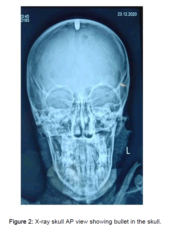 neurology-skull